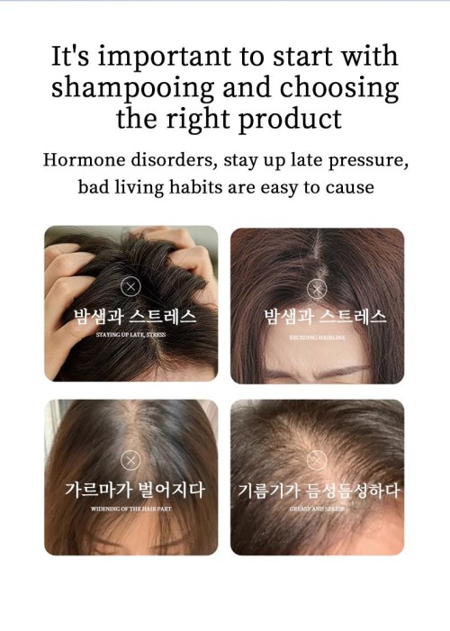 Black garlic shampoo, black garlic fermented ginger, oil control smoothing shampoo
