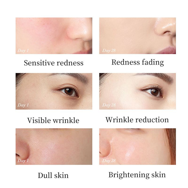 Korean cosmetics OEM Snail collagen proteinallantoin squalane nicotinamide moisturizer