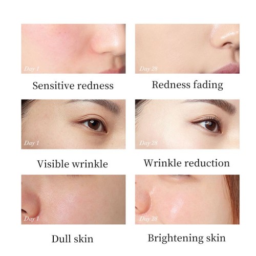 Korean cosmetics OEM Snail collagen proteinallantoin squalane nicotinamide moisturizer