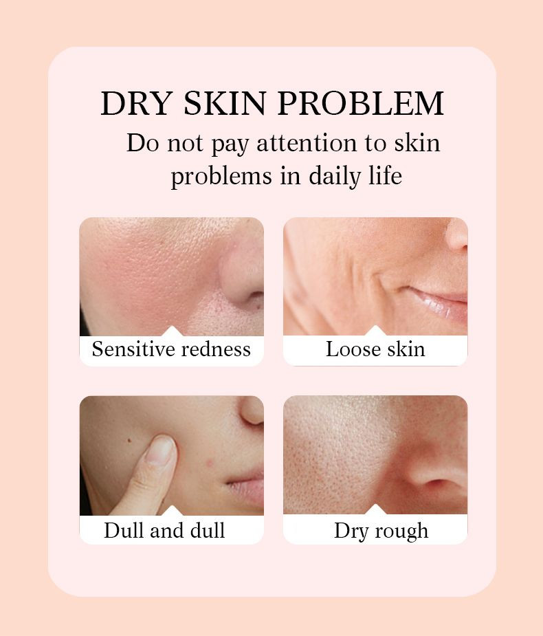 Rose hip Oil Facial Whitening Repair Essence, Rose Essential oil, Rose Lotion moisturizing