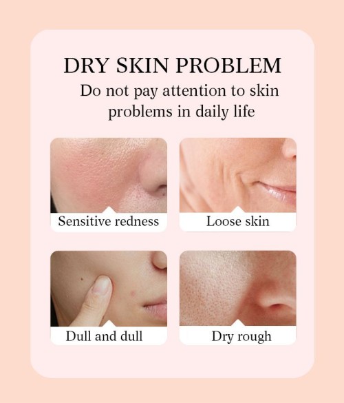 Rose hip Oil Facial Whitening Repair Essence, Rose Essential oil, Rose Lotion moisturizing
